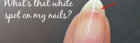 white spot nails
